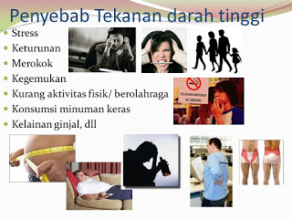 Illustration for article titled Obat Darah Tinggi Sebaiknya Diminum Kapan
